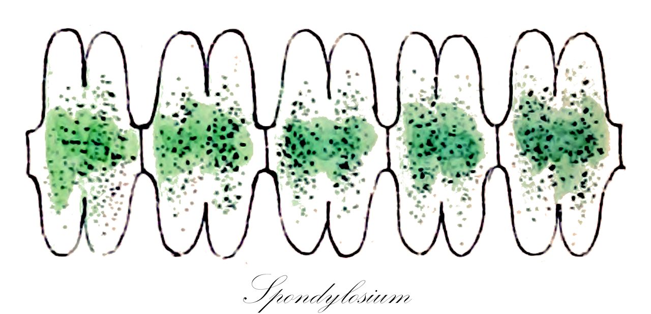 Spondylosium - Desmidiaceae,Biota,Plantae,Charophyta,Conjugatophyceae,Desmidiales,Desmidiaceae,Spondylosium